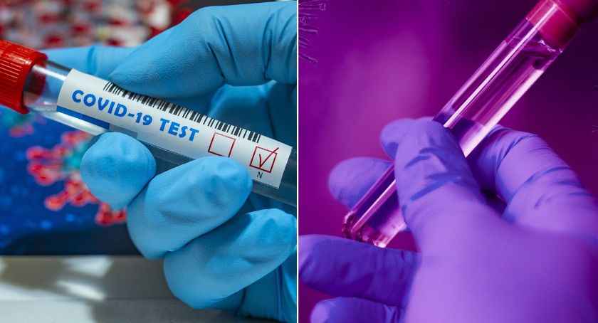 Koronawirus: 179 zakażeń w kujawsko-pomorskim. 27 osób z Włocławka i powiatu włocławskiego
