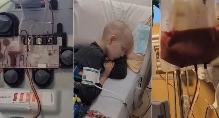 Trwa batalia o zdrowie i życie Kacperka Tesznera z Włocławka. Przeszedł ważny zabieg [VIDEO]
