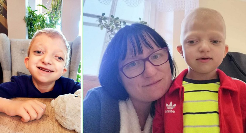 Kubuś choruje na bardzo rzadką chorobę. Przed nim jeszcze kilka operacji