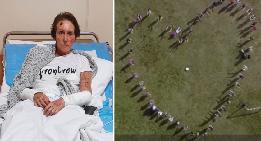 Zespół Szkół nr 3 we Włocławku zorganizował CHALLENGE DLA MONIKI. Wybuch paliwa do biokominka prawie pozbawił ją życia