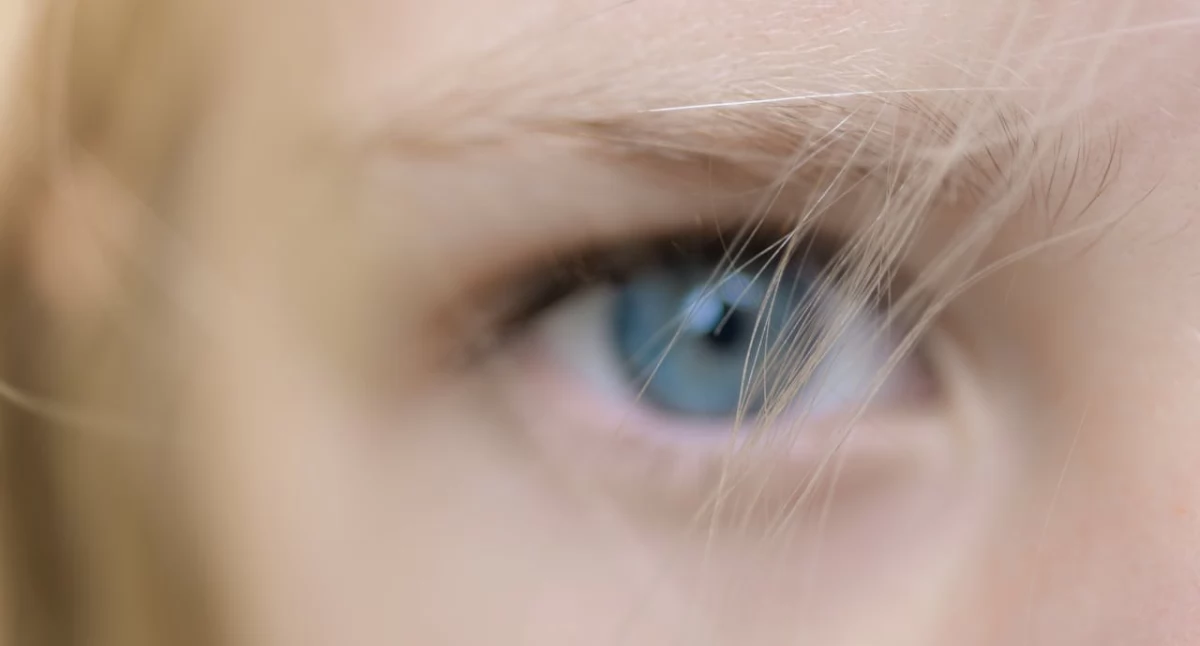 Gdy skóra traci gładkość — skąd bierze się efekt „skórki pomarańczy”?