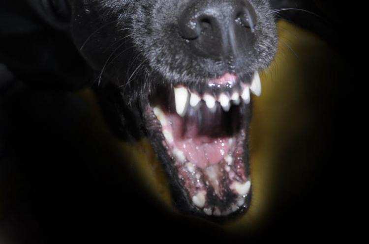 Dziewczynka pogryziona przez psa! Dziecko z obrażeniami trafiło do szpitala