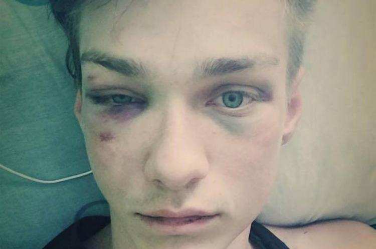 Skatowali go w centrum Włocławka. Sprawcy wciąż na wolności