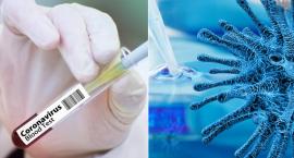 Sytuacja epidemiologiczna w Gminie Kowal